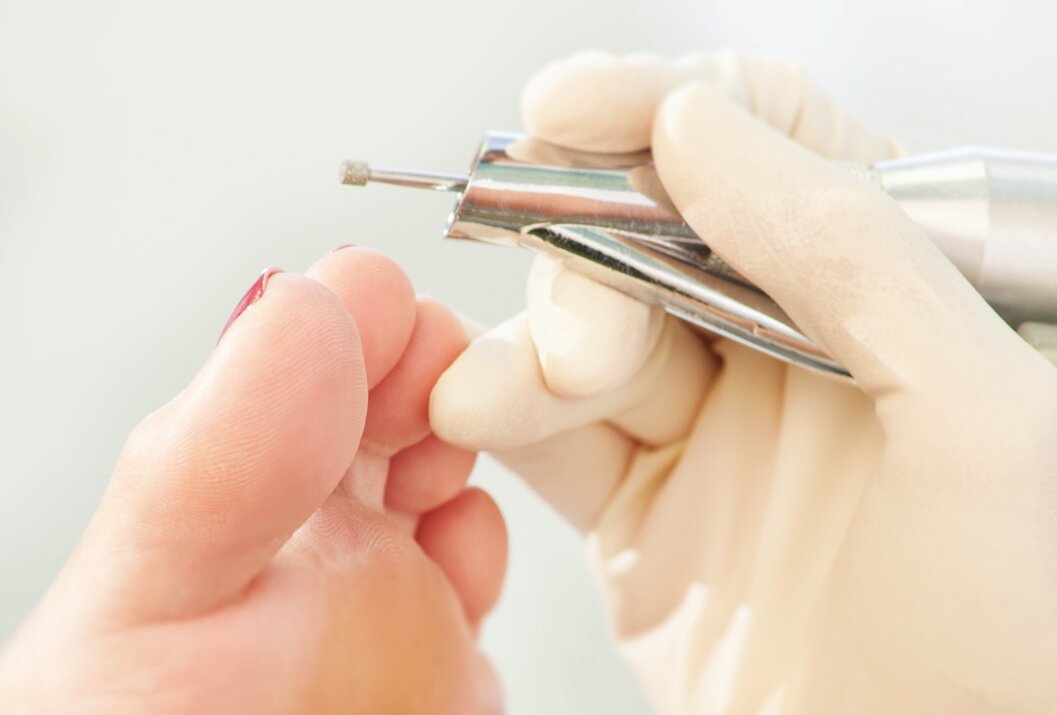 Fußpflege mit Fräser und Handschuhen an Zehennagel